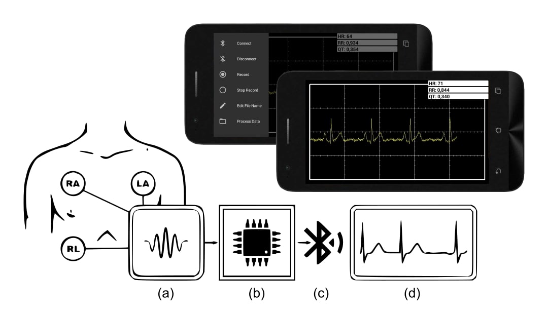 Portable Electrocardiogram (ECG) and Heart Rate Monitoring System Using ...